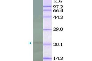 WB analysis of recombinant IL18, using IL18 antibody (1/1000 dilution). (IL-18 anticorps  (full length))