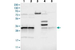 Western blot analysis of Lane 1: RT-4, Lane 2: U-251 MG, Lane 3: Human Plasma, Lane 4: Liver, Lane 5: Tonsil with MRPL45 polyclonal antibody  at 1:250-1:500 dilution.