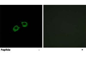 Immunofluorescence analysis of A-549 cells, using ARFGEF2 polyclonal antibody . (ARFGEF2 anticorps)