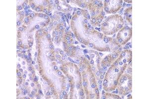 anti-Acetyl-CoA Acyltransferase 1 (ACAA1) antibody