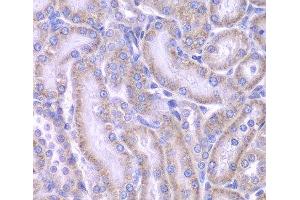 Immunohistochemistry of paraffin-embedded Rat kidney using ACAA1 Polyclonal Antibody at dilution of 1:100 (40x lens). (ACAA1 anticorps)
