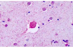 Anti-P2RY8 antibody IHC staining of human brain, cortex. (P2RY8 anticorps  (Cytoplasmic Domain))