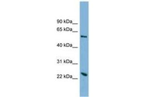 Image no. 1 for anti-Transmembrane Protein 161A (TMEM161A) (AA 179-228) antibody (ABIN6742031) (TMEM161A anticorps  (AA 179-228))