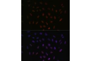 Immunofluorescence analysis of U-2 OS cells using SRSF3 antibody (ABIN6132649, ABIN6148465, ABIN6148466 and ABIN6221693) at dilution of 1:100.