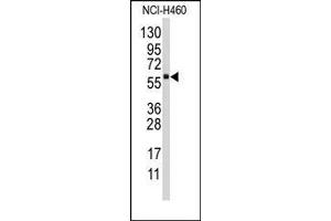 Image no. 1 for anti-Cytochrome P450, Family 4, Subfamily F, Polypeptide 12 (CYP4F12) (C-Term) antibody (ABIN360265) (CYP4F12 anticorps  (C-Term))