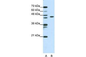 WB Suggested Anti-ZBTB9 Antibody Titration:  0. (ZBTB9 anticorps  (N-Term))