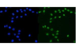 anti-Ataxin 3 (ATXN3) (AA 226-254), (C-Term) antibody