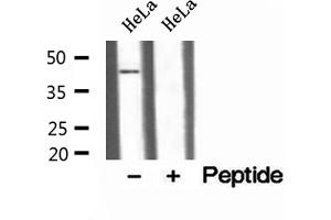 Western blot analysis of extracts of HeLa cells, using TTL antibody.