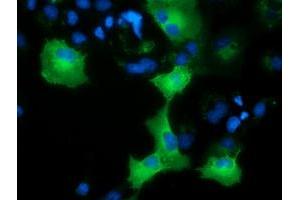 Immunofluorescence (IF) image for anti-Adenylate Kinase 5 (AK5) antibody (ABIN1496533) (Adenylate Kinase 5 anticorps)