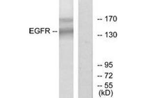 Western blot analysis of extracts from HT-29 cells, using EGFR (Ab-1172) Antibody. (EGFR anticorps  (AA 1139-1188))