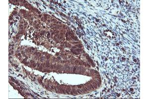 Image no. 5 for anti-serpin Peptidase Inhibitor, Clade B (Ovalbumin), Member 1 (SERPINB1) (AA 77-306) antibody (ABIN1491671)