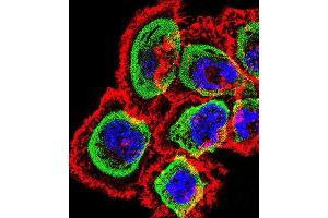 Immunofluorescence (IF) image for anti-Regulator of Calcineurin 1 (RCAN1) antibody (ABIN2998994)