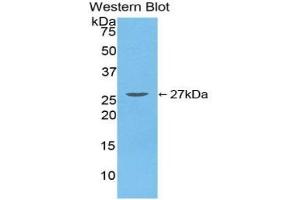 Detection of Recombinant TGFbI, Human using Polyclonal Antibody to Transforming Growth Factor Beta Induced Protein (TGFbI)