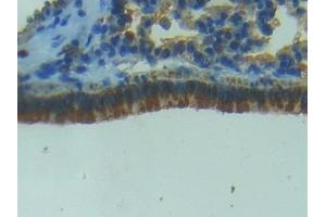 Detection of NOS2 in Mouse Lung Tissue using Polyclonal Antibody to Nitric Oxide Synthase 2, Inducible (NOS2)