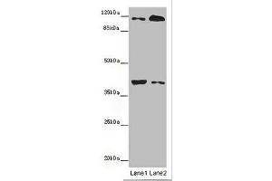 Western blot All lanes: MILR1 antibody at 14 μg/mL Lane 1: Mouse brain tissue Lane 2: HepG2 whole cell lysate Secondary Goat polyclonal to rabbit IgG at 1/10000 dilution Predicted band size: 39, 28, 29 kDa Observed band size: 39, 120 kDa (Allergin-1 anticorps  (AA 249-343))