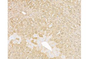 Immunohistochemistry (IHC) image for anti-Arginase, Liver (ARG1) (AA 1-322) antibody (ABIN7453894)