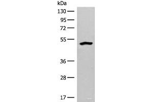 Western blot analysis of Human fetal liver tissue lysate using FBXO9 Polyclonal Antibody at dilution of 1:200 (FBXO9 anticorps)