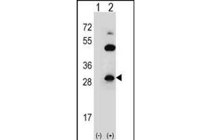 Western blot analysis of CLDN2 (arrow) using rabbit polyclonal CLDN2 Antibody  (ABIN656564 and ABIN2845824). (Claudin 2 anticorps  (C-Term))