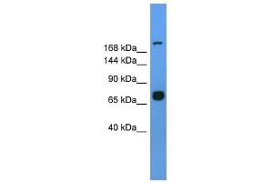 WB Suggested Anti-Myh7 Antibody Titration: 0. (MYH7 anticorps  (Middle Region))