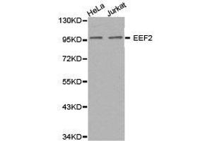 Western Blotting (WB) image for anti-Eukaryotic Translation Elongation Factor 2 (EEF2) antibody (ABIN1872437) (EEF2 anticorps)