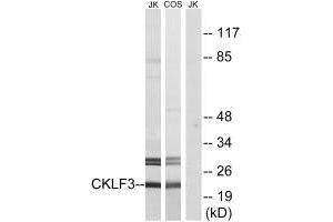 Western blot analysis of extracts from Jurkat cells and COS cells, using CKLF3 antibody. (CMTM3 anticorps  (N-Term))