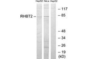 Western blot analysis of extracts from HepG2/HeLa cells, using RHBT2 Antibody. (RHOBTB2 anticorps  (AA 61-110))