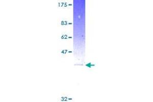 Image no. 1 for ADP-Ribosylation Factor 1 (ARF1) (AA 1-181) protein (GST tag) (ABIN1345453)