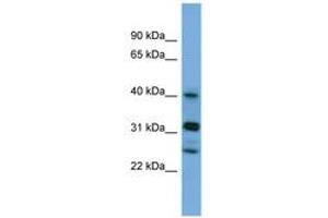Image no. 1 for anti-Periphilin 1 (PPHLN1) (N-Term) antibody (ABIN6745665) (PPHLN1 anticorps  (N-Term))