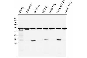 Western blot analysis of ATP citrate lyase using anti-ATP citrate lyase antibody (ABIN6719406).
