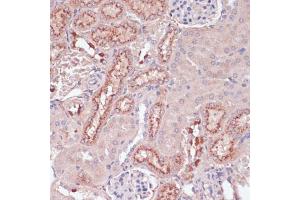 Immunohistochemistry of paraffin-embedded mouse kidney using Lysozyme (Lysozyme (LYZ)) antibody (ABIN6133802, ABIN6143409, ABIN6143412 and ABIN6217538) at dilution of 1:100 (40x lens). (LYZ anticorps  (AA 1-100))