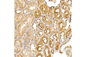 Immunohistochemistry of paraffin-embedded rat kidney using PGC1α Rabbit mAb  at dilution of 1:1000 (40x lens). (PPARGC1A anticorps)