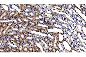 Detection of GPX1 in Rat Kidney Tissue using Polyclonal Antibody to Glutathione Peroxidase 1 (GPX1) (Glutathione Peroxidase 1 anticorps  (AA 48-201))