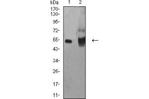 Western blot analysis using ALDH1A1 mouse mAb against HepG2 (1) and A549 (2) cell lysate. (ALDH1A1 anticorps  (AA 1-110))