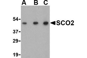 Western blot analysis of SCO2 in human liver tissue lysate with SCO2 antibody at (A) 0. (SCO2 anticorps  (C-Term))