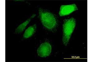 Immunofluorescence of purified MaxPab antibody to C20orf132 on HeLa cell. (C20orf132 anticorps  (AA 1-608))