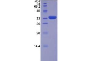 SDS-PAGE analysis of Human TRAF5 Protein. (TRAF5 Protéine)