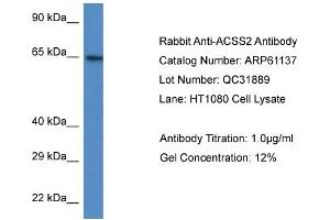 Western Blotting (WB) image for anti-Acyl-CoA Synthetase Short-Chain Family Member 2 (ACSS2) (N-Term) antibody (ABIN2788690) (ACSS2 anticorps  (N-Term))