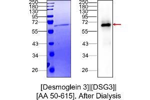 Western Blotting (WB) image for Desmoglein 3 (DSG3) (AA 50-615) protein (His tag) (ABIN3079094) (Desmoglein 3 Protein (DSG3) (AA 50-615) (His tag))
