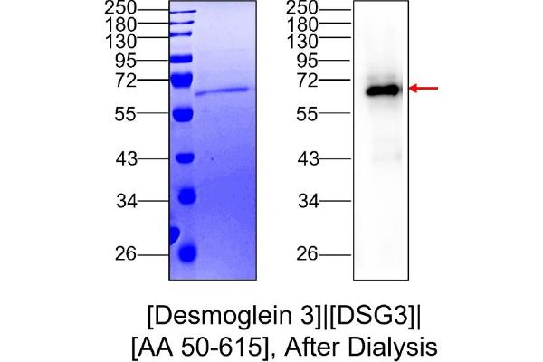 Desmoglein 3 Protein (DSG3) (AA 50-615) (His tag)