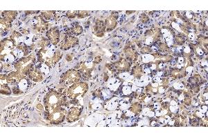 Detection of IFNb in Human Stomach Tissue using Monoclonal Antibody to Interferon Beta (IFNb)