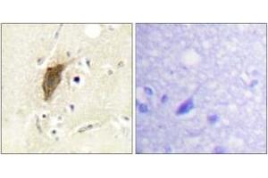 Immunohistochemistry analysis of paraffin-embedded human brain, using Myosin regulatory light chain 2 (Phospho-Ser18) Antibody.