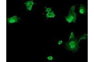 Image no. 8 for anti-tRNA Methyltransferase 2 Homolog A (TRMT2A) antibody (ABIN1501516)