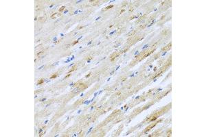 Immunohistochemistry of paraffin-embedded rat heart using STRN antibody at dilution of 1:100 (x40 lens). (Striatin anticorps)
