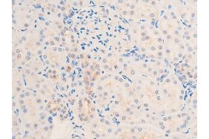 ABIN6267067 at 1/100 staining rat kidney tissue sections by IHC-P.