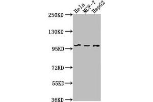 Western Blot Positive WB detected in: Hela whole cell lysate, MCF-7 whole cell lysate, HepG2 whole cell lysate All lanes: EIF4G2 antibody at 1:1000 Secondary Goat polyclonal to rabbit IgG at 1/50000 dilution Predicted band size: 103, 99 kDa Observed band size: 99 kDa (EIF4G2 anticorps  (AA 706-907))