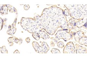 Detection of DSG3 in Human Placenta Tissue using Polyclonal Antibody to Desmoglein 3 (DSG3) (Desmoglein 3 anticorps  (AA 858-999))