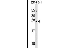 NXNL1 Antibody (Center) (ABIN1538700 and ABIN2849312) western blot analysis in ZR-75-1 cell line lysates (35 μg/lane). (NXNL1 anticorps  (AA 94-121))