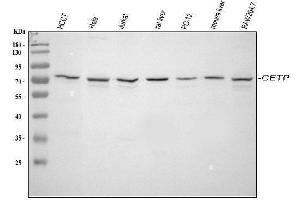 Western blot analysis of CETP using anti-CETP antibody (ABIN7602439).