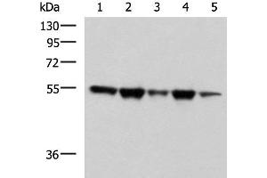 Western blot analysis of A172 Hela HepG2 K562 and PC3 cell lysates using FKBP5 Polyclonal Antibody at dilution of 1:600 (FKBP5 anticorps)