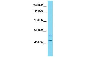 Host:  Rabbit  Target Name:  TTC7A  Sample Type:  Stomach Tumor lysates  Antibody Dilution:  1. (TTC7A anticorps  (N-Term))